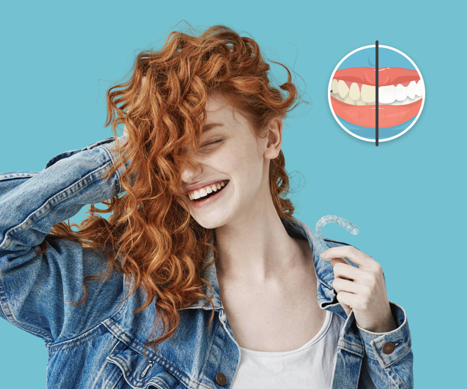 Bright Aligners