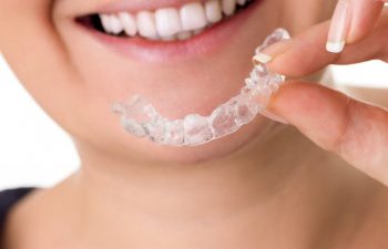 Woman with perfect teeth holding invisalign
