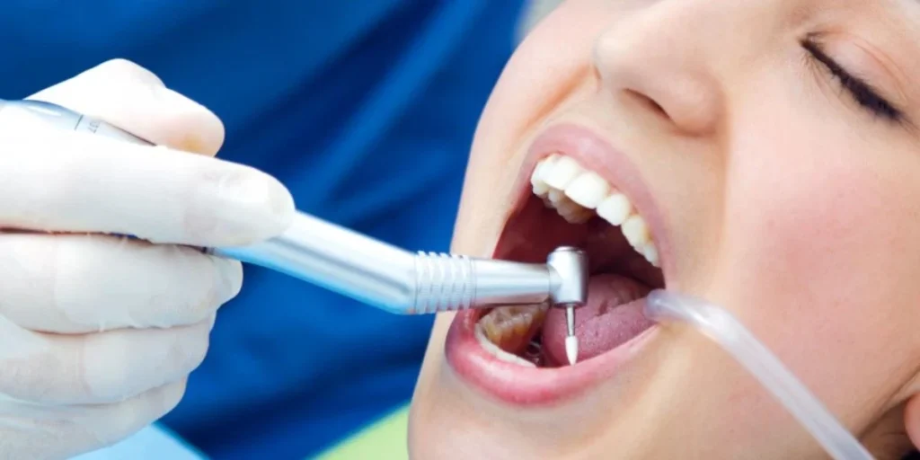 Dental canal cleaning Duluth treatment for painless tooth care