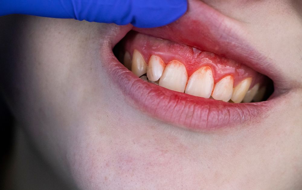 What Tobacco Really Does to Your Teeth and Gums 2 Dentist performing an oral cancer screening exam because of Tobacco that damaged his teeth